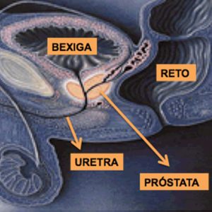 Saiba quais são as principais doenças que acometem a próstata, as formas de diagnóstico, prevenção e tratamento. 